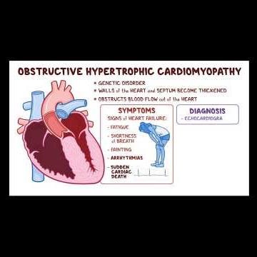 hocm ( hypertrophic obstructive cardiomyopathy )#heart #heartdesease