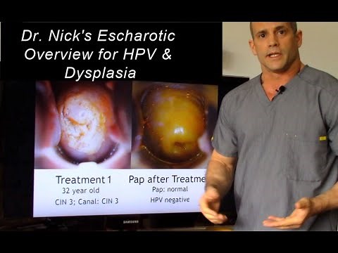 Dr. Nick's Escharotic Treatment for HPV and Dysplasia