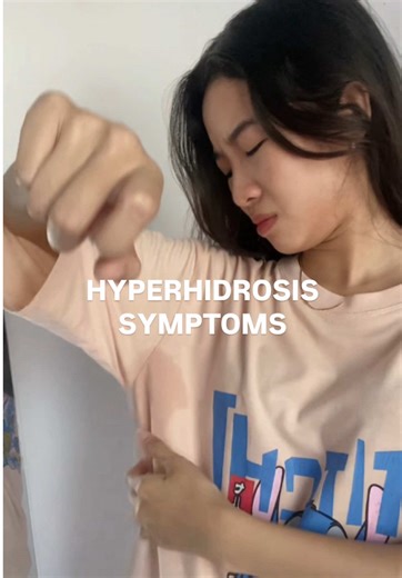 Effective Strategies for Managing Hyperhidrosis