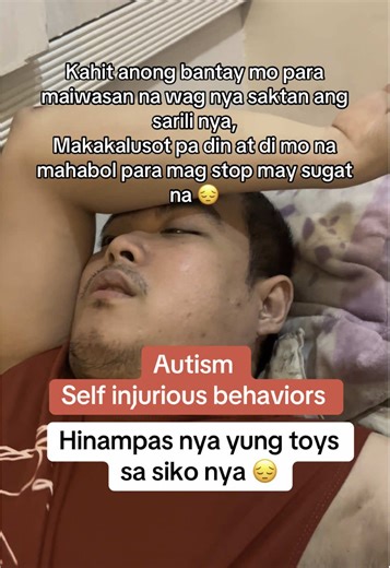 Minsan akala mo naglalaro lang or simpleng nagpupunas lang pero sinasaktan nya na pala sarili nya 😔 #autism #autismawareness #autismacceptance #autismjourney #nonverbalautism #nonverbalautism #asd