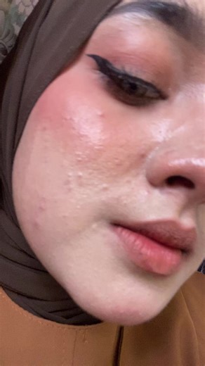 Makeup Acak-Acakan Untuk Zoom: Tips & Trik