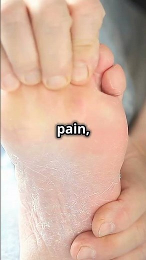 Diabetes Neuropathy- Cause of Numb feet.