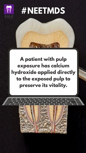 NEET MDS Prep App on Instagram: "This is a concept-check NEET MDS question — can you answer correctly? A patient with pulp exposure has calcium hydroxide applied directly to the exposed pulp to preserve its vitality. What is this procedure called? A. Indirect pulp capping B. Partial pulpotomy C. Direct pulp capping D. Cvek pulpotomy Build exam readiness through regular and focused Dental PG practice on PULP - https://pulp.mcqdb.com/ #MedicalStudents #DentalStudents #DentistryLife #MedicalEntranc