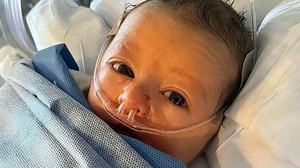 My baby boy died at 2 months old after his skin began to slide off his body