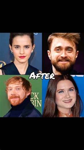 harry potter cast before and after edition# trending edits#
