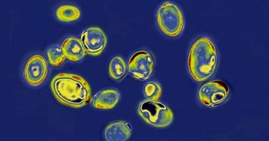 Fungal "superbug" causes concern among U.S. health officials