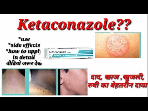 KETOCONAZOLE cream / Lotion uses,side effects, how to apply