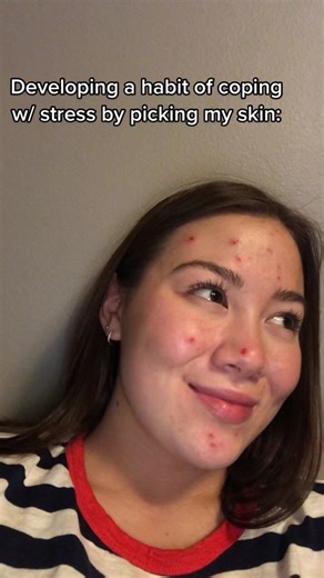 I have never shown these photos before, but this is what my dermatillomania looked like at its worse. As Miss America, I speak openly about my struggles with Dermatillomania, but I wanted to show what it actually looks like. Chronic skin picking IS a psychological condition and is much more common than you may think. If you suspect you have dermatillomania, no, you’re not crazy, and yes, you can overcome it. :)