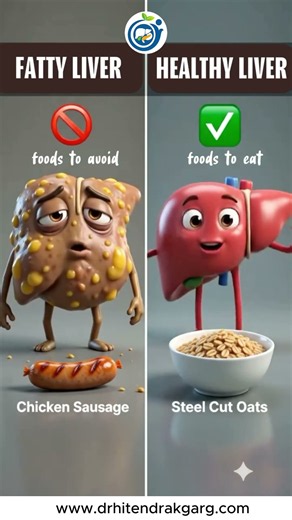 Fatty Liver Diet: Foods to Avoid & Best Foods for Liver Health | Dr. Hitendra K. Garg