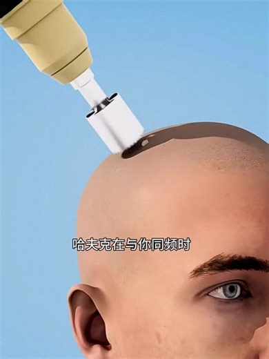 #Brain-Computer Interface (BCI)‌