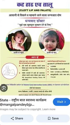 Birth defect:causes, types and treatments|Health care