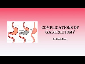 Complications of gastrectomy