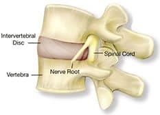 Lower Back Pain Symptoms, Diagnosis, and Treatments Pain