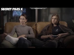 Clip 26 ‐ Plaster leg cast SLC , broken leg