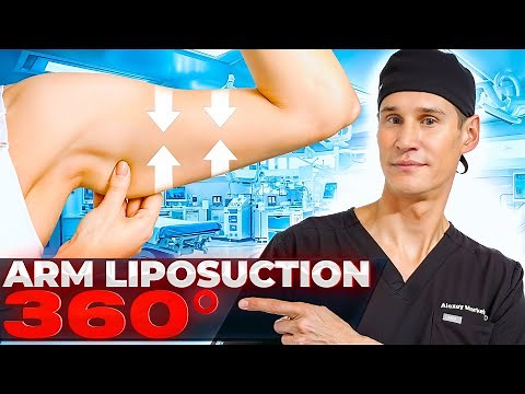 Awake Arm Lipo 360: What's the Real Difference?