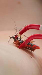 12K views · 80 reactions | Assassin Bug Bite DESTROYS Me! | Mark Vins | Facebook