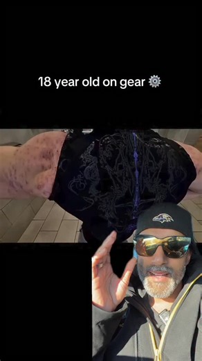 Another reason not to use gear. #gear #workout #fitness | Zain Hasan