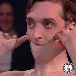227M views · 246K reactions | Garry Turner (UK) is able to stretch his skin to a distended length of 15.8 cm (6.25 in) due to a rare medical condition. | Guinness World Records | Facebook