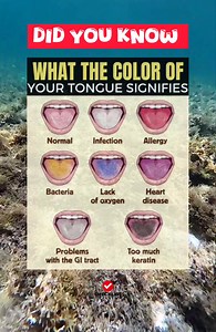 1.5M views · 2.7K reactions | DID YOU KNOW: WHAT THE COLOR OF YOUR TONGUE SIGNIFIES | Checklist Studio | Facebook