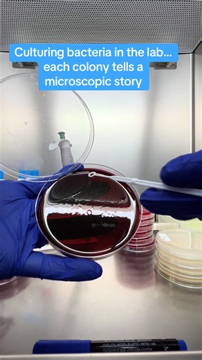 Exploring Bacterial Cultures: Microscopic Stories Unveiled