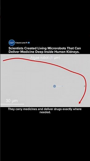 Scientists Create Living Microrobots That Can Deliver Medicine Deep Inside the Kidney #medical #tech