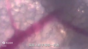 3.4M views · 21K reactions | 蚊子醫生。 每叮一次，就像是進行一次微創手術。 https://video.weibo.com/show?fid=1034:5095312419913757 | Smart Robots 智慧機器人 | Facebook