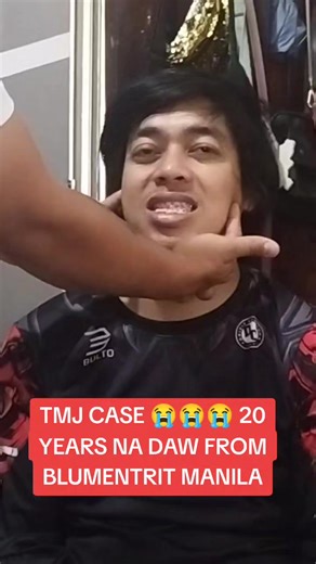TMJ Treatment Journey in Manila