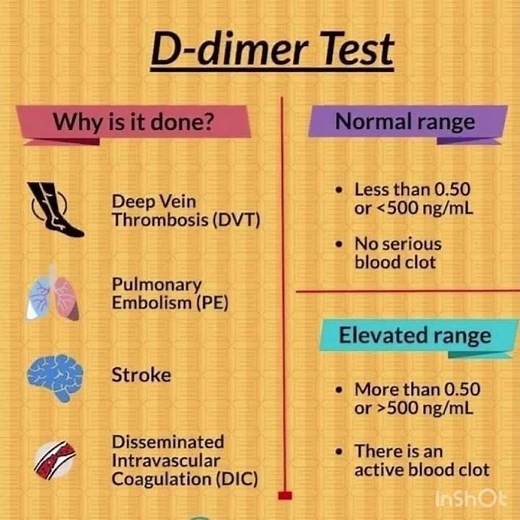D - dimer test