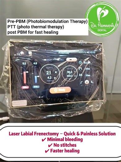 labial frenectomy with laser dentistry #8501802222 #smiledesigndental