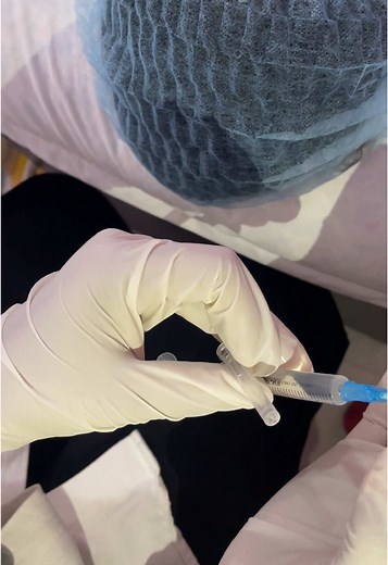 fibroblast plasma treatment #thegirlszone❤️ #nepalgunj #nepalgunjkhajura