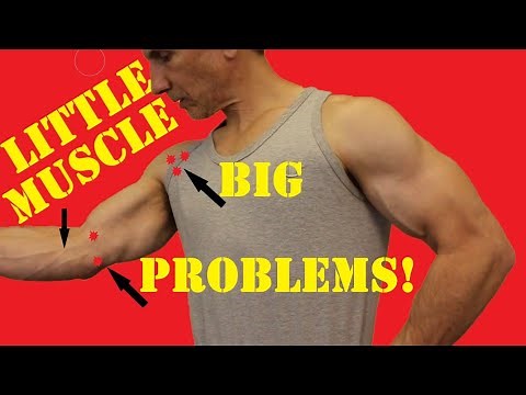 Pronator Teres Pain: Stop Forearm Pain from Ruining Your Workouts