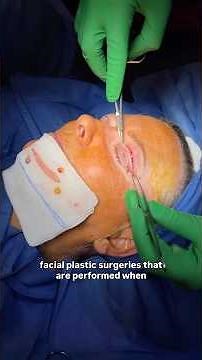 Upper Eyelid Surgery with Dr. Madnani | 1 week after