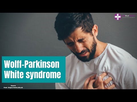 Wolff Parkinson White (WPW) syndrome | Cardiac Rhythm