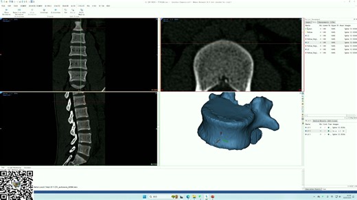 医学建模：Mimics的CT导入和软件界面介绍
