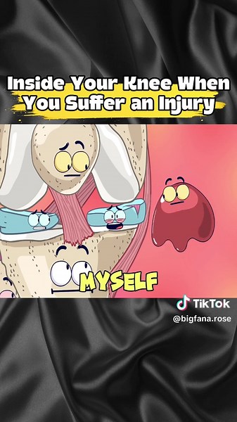 knee injury animation: meniscus tear explained in plain English