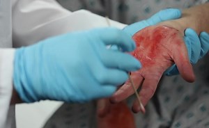 Case Study Julie, Evidence Collection: Hand Swabbing