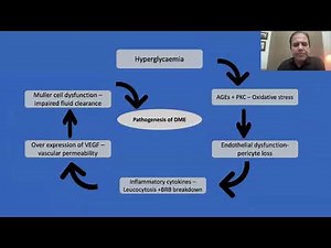 Lecture: Approach to the Management of Diabetic Macular Edema