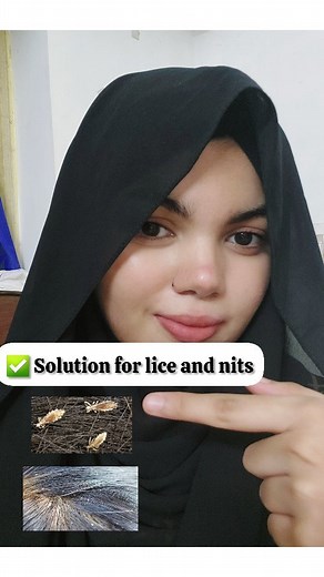 Marzuka kalwath | Skin Aesthetician ✨ on Instagram: "Solution for head lice and nits 🌟Use permethrin lotion How to use it? 🌟First, wash your hair normally like you always do with normal shampoo 🌟Then let your hair try 🌟After your hair is dried apply permethrin lotion on your scalp 🌟And leave it for 10 min 🌟Then wash it off with water 🌟In semi wet hair use a lice comb to remove all lice and nits from your scalp For men, women, kids, adults Use it once a month 🚫No side effects Friendly rem