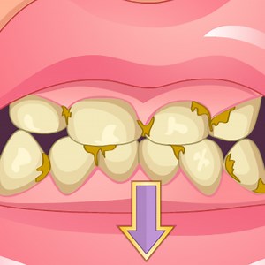 Bad Teeth Makeover: Play Bad Teeth Makeover online for free now.