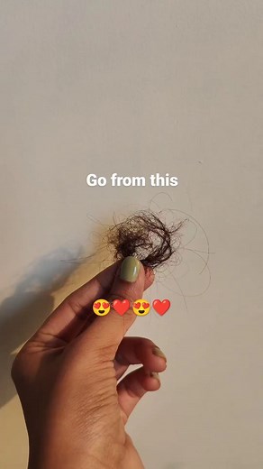 HOMEMADE ORGANIC MAGIC on Instagram: "Powerful remedy to control hairfall✨ Follow for more @hairfallsolutions.in Cc@beauty.and.diy06 #hairgrowthtips #haircaretips #gingerjuice #gingerforhair #hairfallsolution #hairfallcontrol #fyp #explorepage✨ #trending #haircare #hairgoals😍 #longhairgirls"