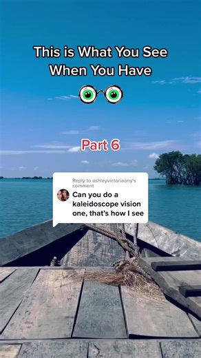 Understanding Kaleidoscope Vision: Symptoms and Causes Explained