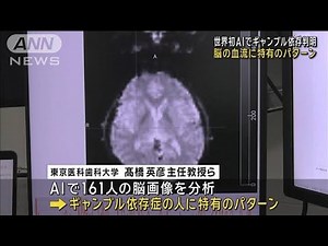 世界初 AIでギャンブル依存判明 脳の血流に特有のパターン(2024年5月6日)