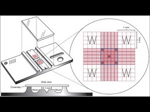 HOW TO COUNT WBC USING HEMACYTOMETER NEUBAUER