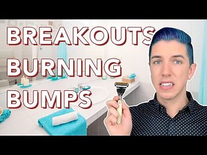 How to Prevent Razor Burn | Shaving 101