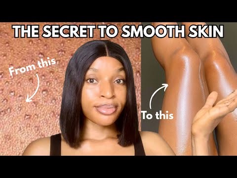 Say Goodbye to Rough, Textured & Bumpy Skin | 5 Products That Actually Work!