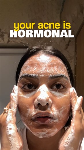 Suman Maurya | Skincare & Science on Instagram: "If acne keeps coming back in the SAME places… it might not be your routine. Here are 10 signs your acne is likely hormone-driven: 1. It clusters around chin / jawline / lower face more than your T-zone. 2. It flares before your period or follows a monthly pattern. 3. The pimples are deep, tender, cyst-like (not just tiny whiteheads). 4. You get fewer “random” breakouts and more “same spot, same cycle.” 5. Your skin feels oilier around flares (even