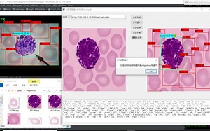 【附程序】基于PyQ5 Efficientdet Opencv Flask的深度学习AI医学图像分析系统