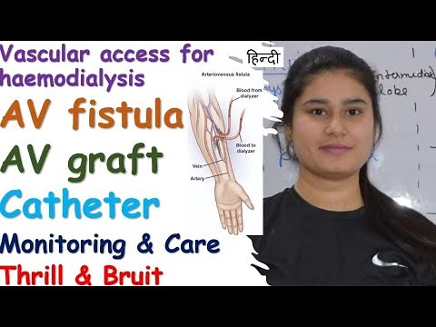 Vascular access for Haemodialysis | AV Fistula | AV Graft | Catheter | Thrill & Bruit | Monitoring