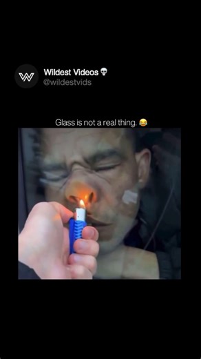 Wild | Weird | Funny 🔌 on Instagram: "🔥🔥🔥🔥🔥 The human nose serves as both a respiratory and sensory organ, playing a critical role in breathing and the sense of smell. Structurally, it is divided into two main parts: the external nose, which includes the nostrils and nasal bridge, and the internal nasal cavity, which is lined with mucous membranes and fine hairs called cilia. These structures help filter, warm, and humidify the air before it reaches the lungs. The nasal septum, made of car