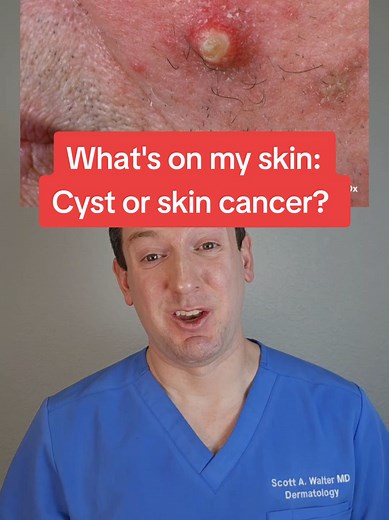 Understanding Squamous Cell Carcinoma Skin Conditions